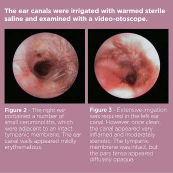 Fig2 Otitis.jpg