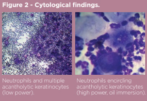 Fig2 pemphigus foliaceus.jpg